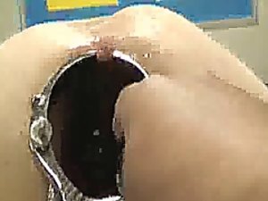 spéculum anal Shocking béante et fist
